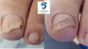 Podolog Bielsko-Biała Gabinet Podologiczny