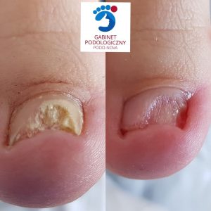 Podolog Bielsko-Biała Gabinet Podologiczny